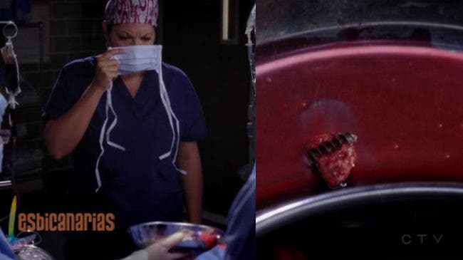 Callie y Arizona 8x09 04